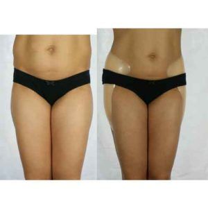 Silicone Hip pads