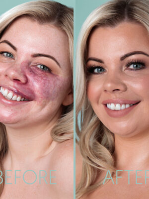 before and after application of dermacolor creme